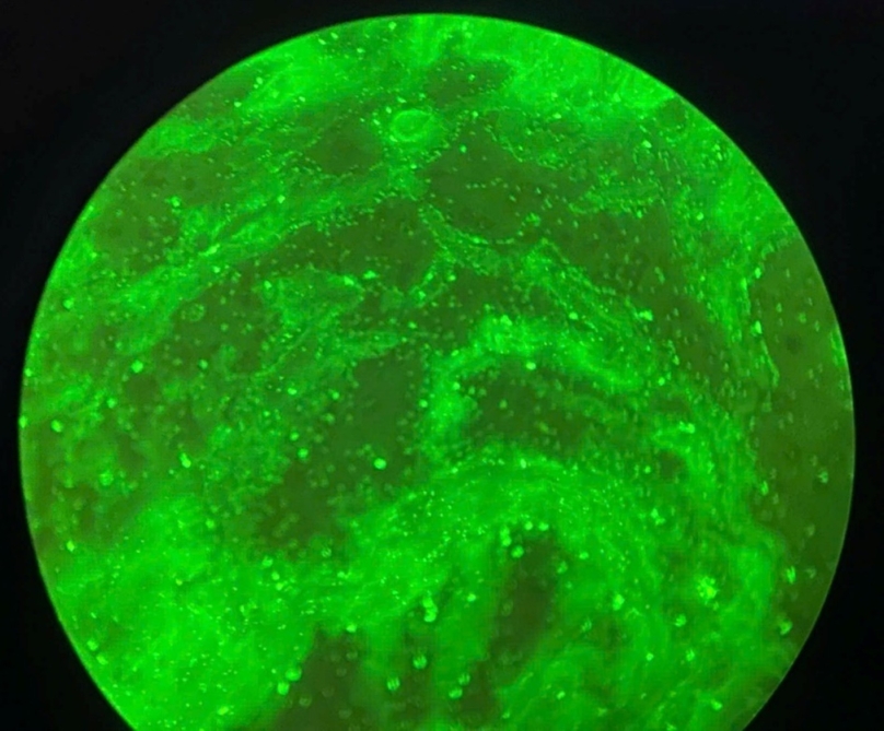 Hình 4: Miễn dịch huỳnh quang gián tiếp âm tính