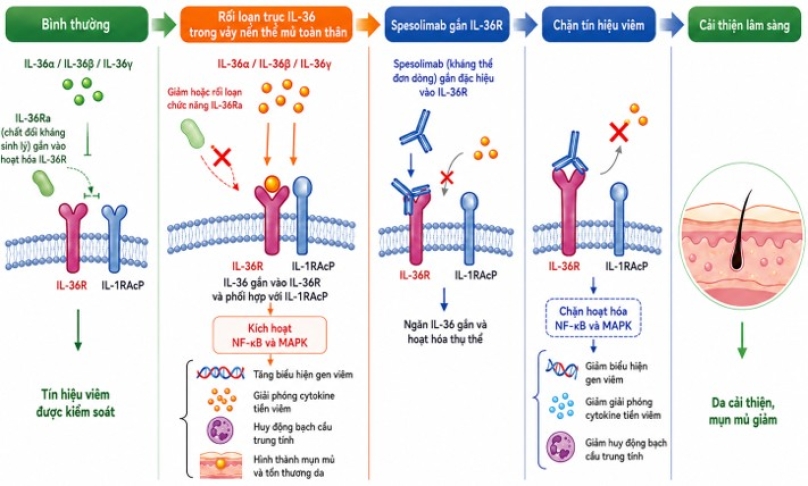 Hình 2. Cơ chế tác động của spesolimab lên cơ chế bệnh sinh vảy nến thể mủ toàn thân