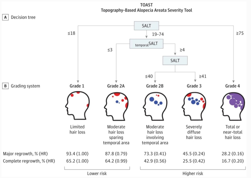 Topographic Phenotypes of Alopecia Areata and Development of a Prognostic Prediction Model and Grading System: A Cluster Analysis.JAMA Dermatol.2019.