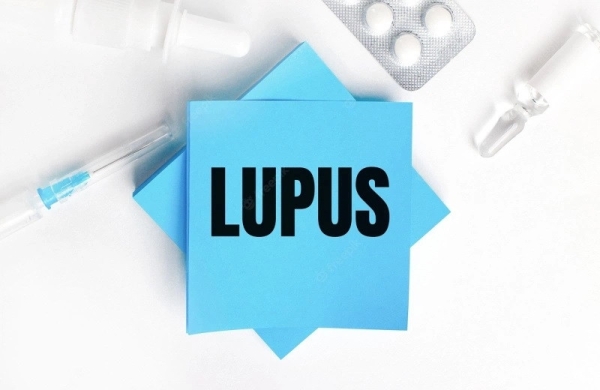 Nhóm thuốc sinh học trong điều trị Lupus ban đỏ hệ thống