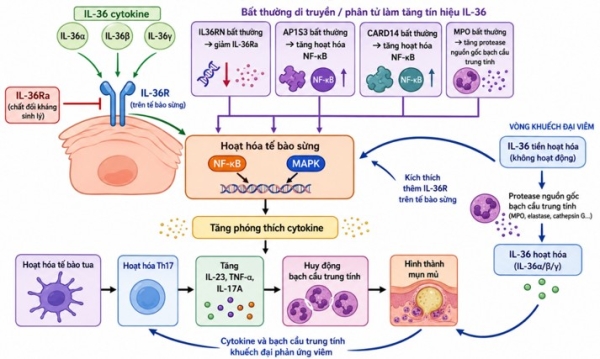 Spesolimab: bước tiến mới trong điều trị vảy nến thể mủ toàn thân